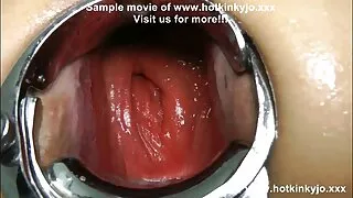 ඩිල්ඩෝස් ඇගේ හොඳම මිතුරන් ය
