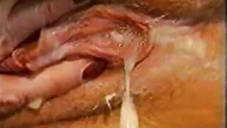කැනේඩියානු